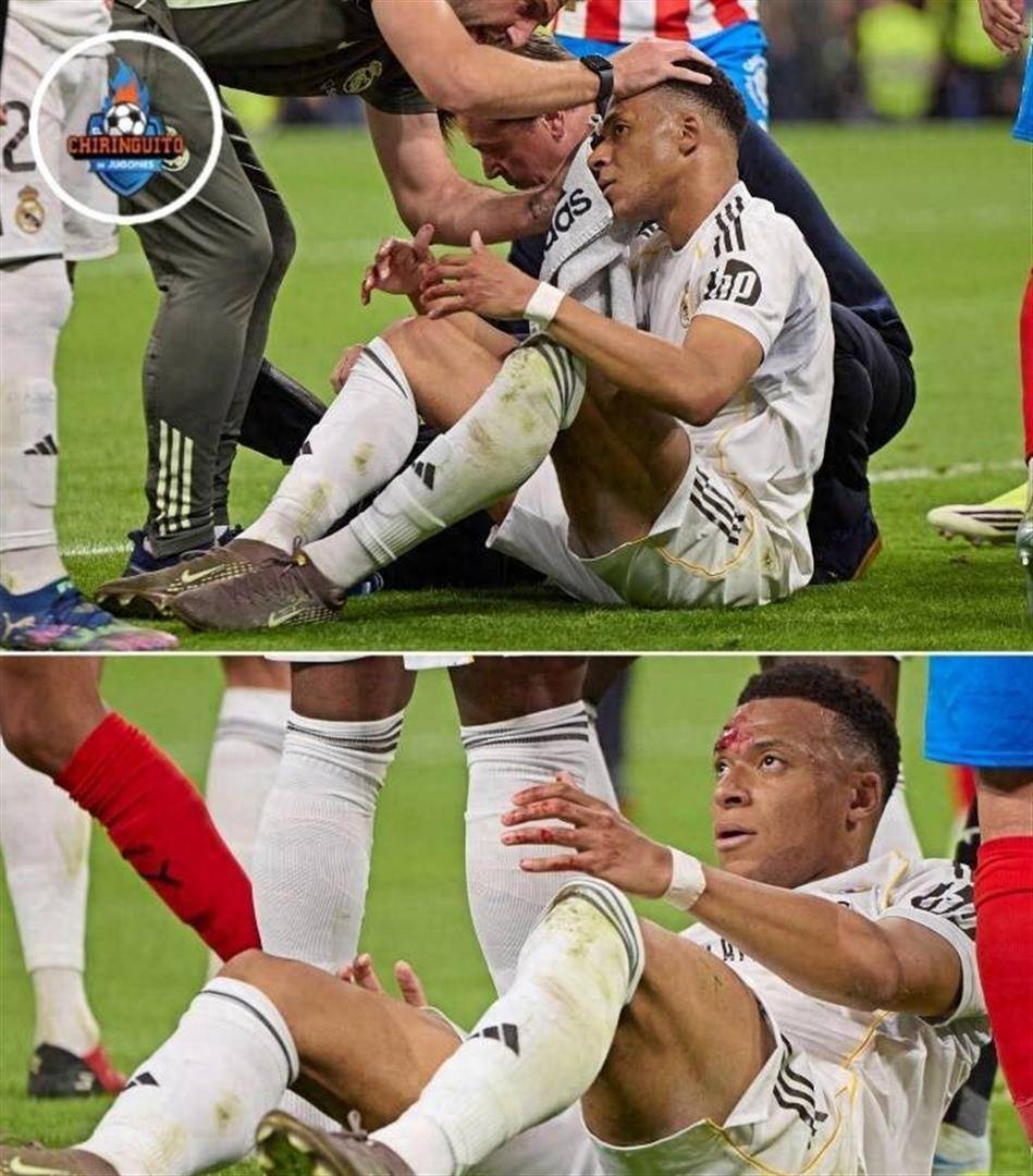 血染伯纳乌！姆巴佩眼角开裂倒地，裁判无视，皇马主帅暴怒：在月球上也是点球！